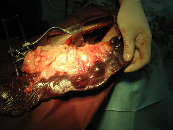 case 11