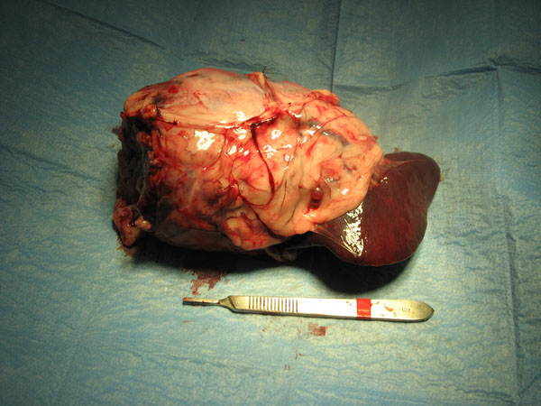 case 11 1